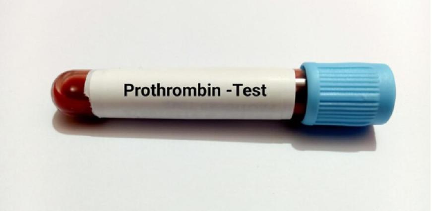All You Need to Know about the Prothrombin Time Test (With INR)