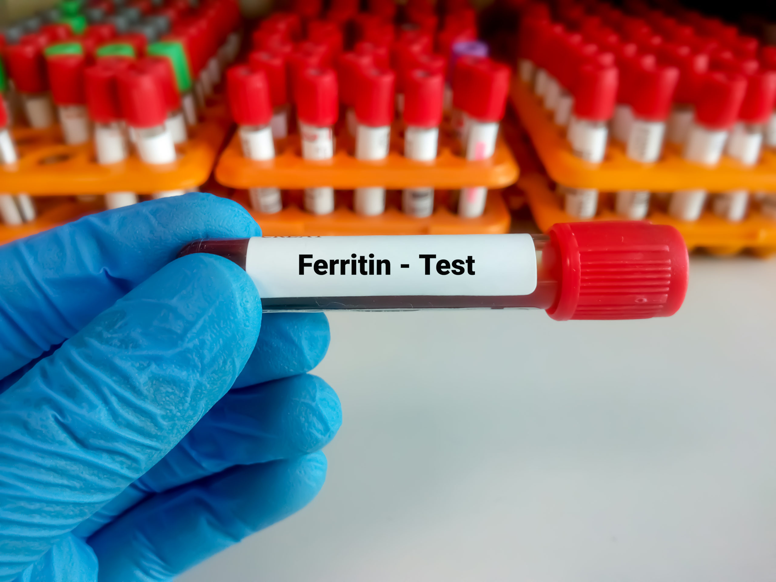 Importance of Ferritin Test: Meaning, Purpose, and Normal Level