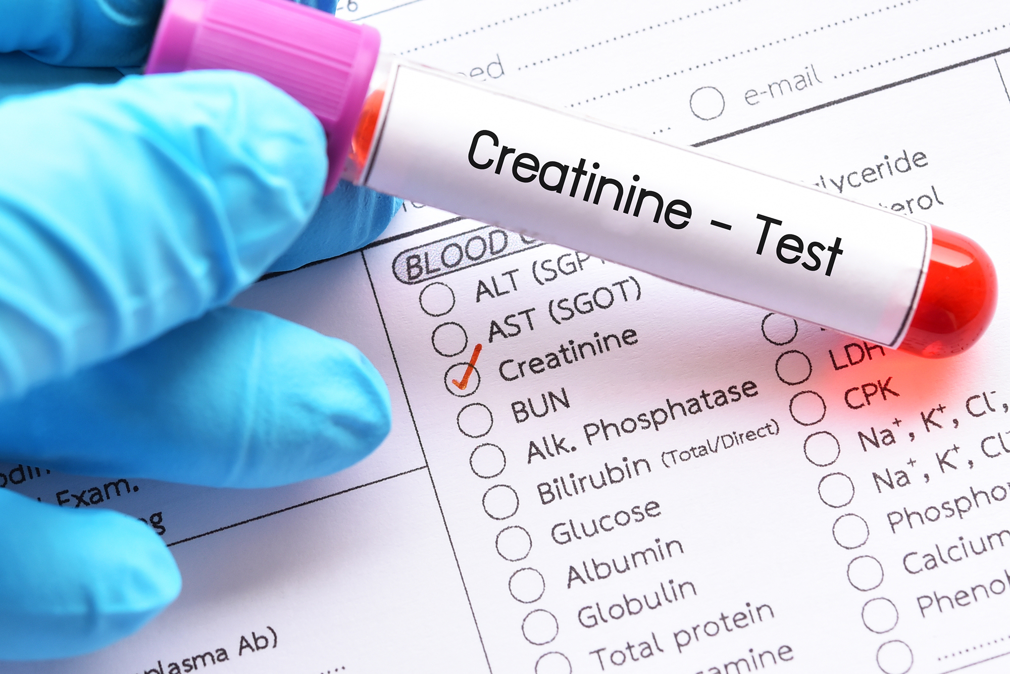 Creatinine Level and its Effect on Kidney Function Health