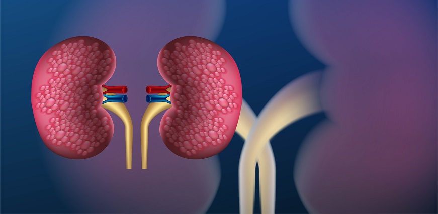 What Can I Do to Keep My Kidneys Healthy?