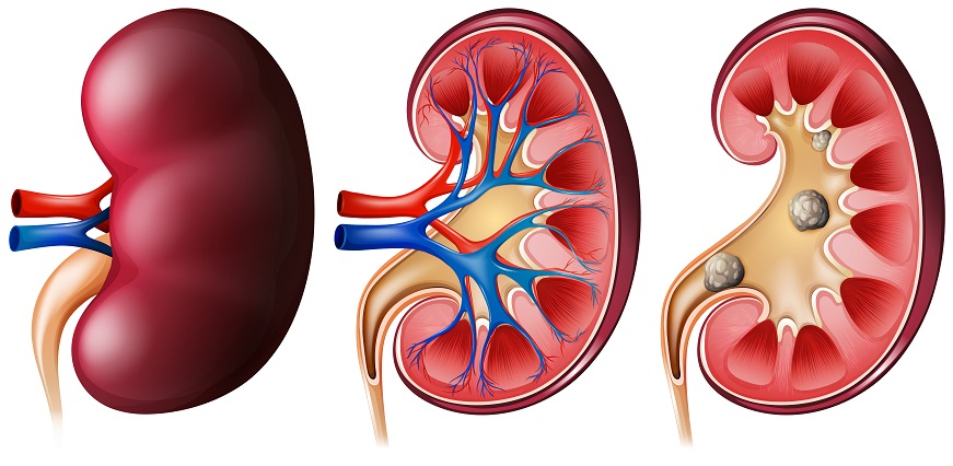 What are Renal Profile Tests and Why They are Performed