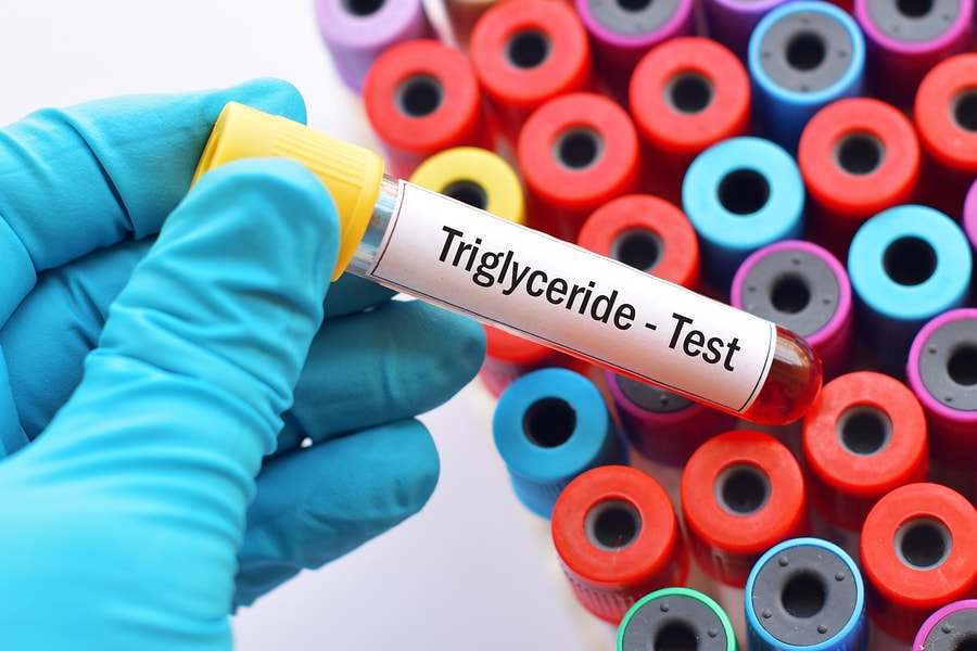 High Triglycerides Level - How to Reduce Triglycerides Naturally