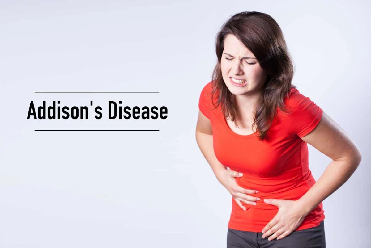 Addison's Disease - Causes, Symptoms, Treatment & Diagnosis | Max Lab