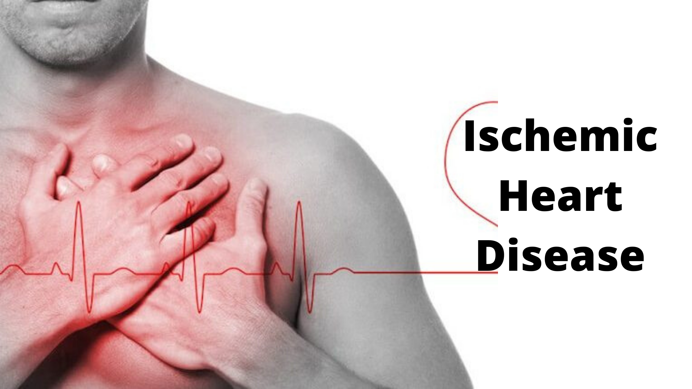 Ischemic Heart Disease (IHD) - Causes, Symptoms, Treatment & Diagnosis