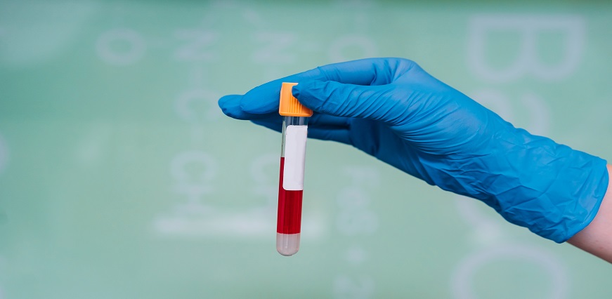 HCV Test - Test Types, Purpose, Normal Range, Preparation