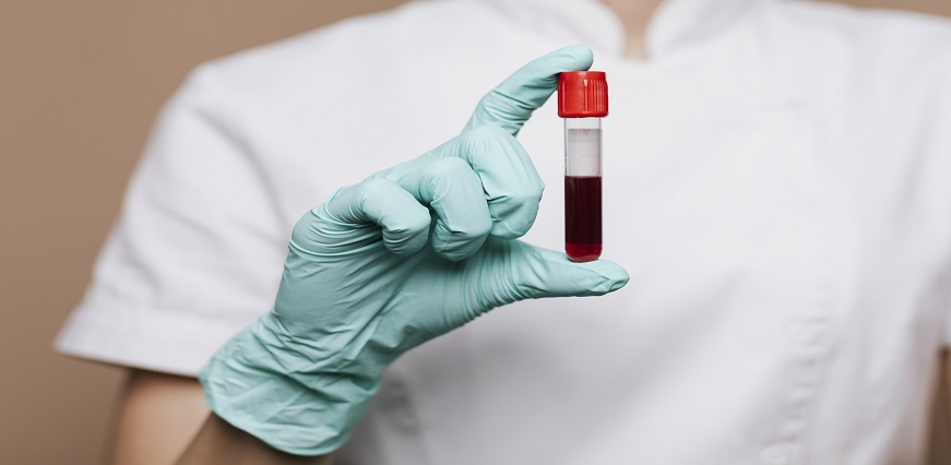 Understanding Blood Infection - Symptoms, Causes & Treatment