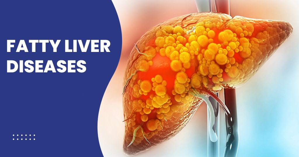 Fatty Liver Symptoms: Causes, Diagnosis, Treatment & Prevention
