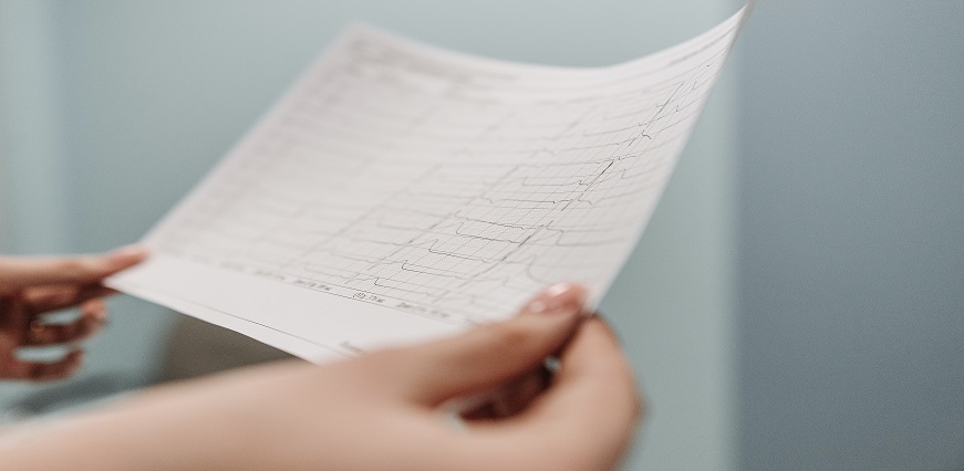 ECG Test Procedure Steps - Preparation, Purpose & Test Results
