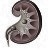 Kidney Stone Symptoms