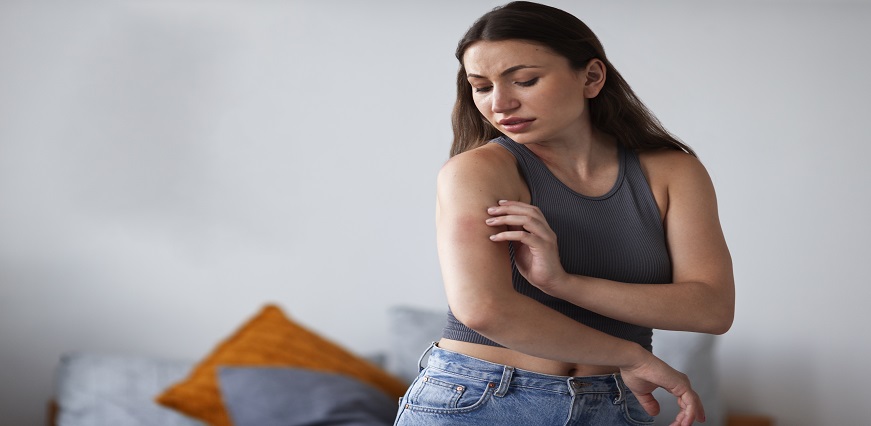 What is Skin Rash: Types, Causes, Symptoms, Treatment and Home Remedies
