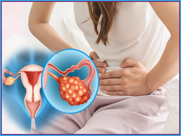 PCOD Kya Hota Hai? जानिए PCOD के Symptoms, Causes, Test और Treatment