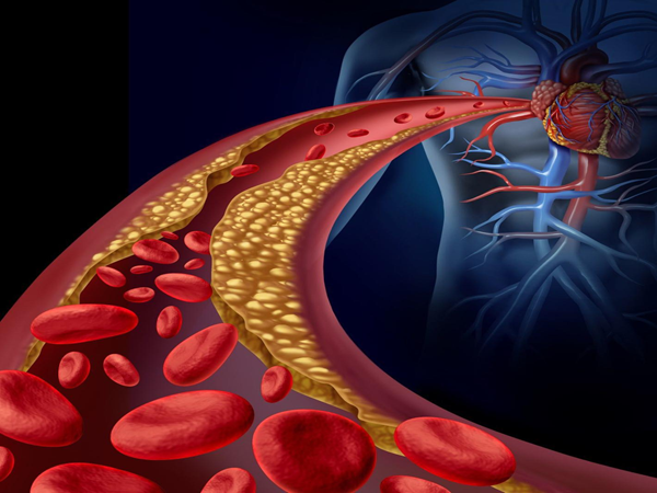 Cholesterol Kya Hota Hai? कोलेस्ट्रॉल क्या होता है?